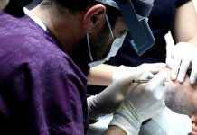 Unlocking the Potential of Antalya: Your Premier Destination for Hair Transplant Excellence Unlocking the Potential of Antalya: Your Premier Destination for Hair Transplant Excellence